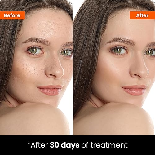 Miniatura 7 de Suero facial cremoso de vitamina C, 10% vitamina C, suero de vitamina C para piel brillante y radiante, tono de piel uniforme, previene el