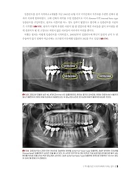 その他 Curriculum Implantology DVD Curriculum Implantology DVD