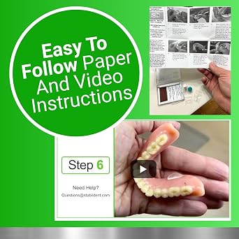 Lower Denture Stabilizers
