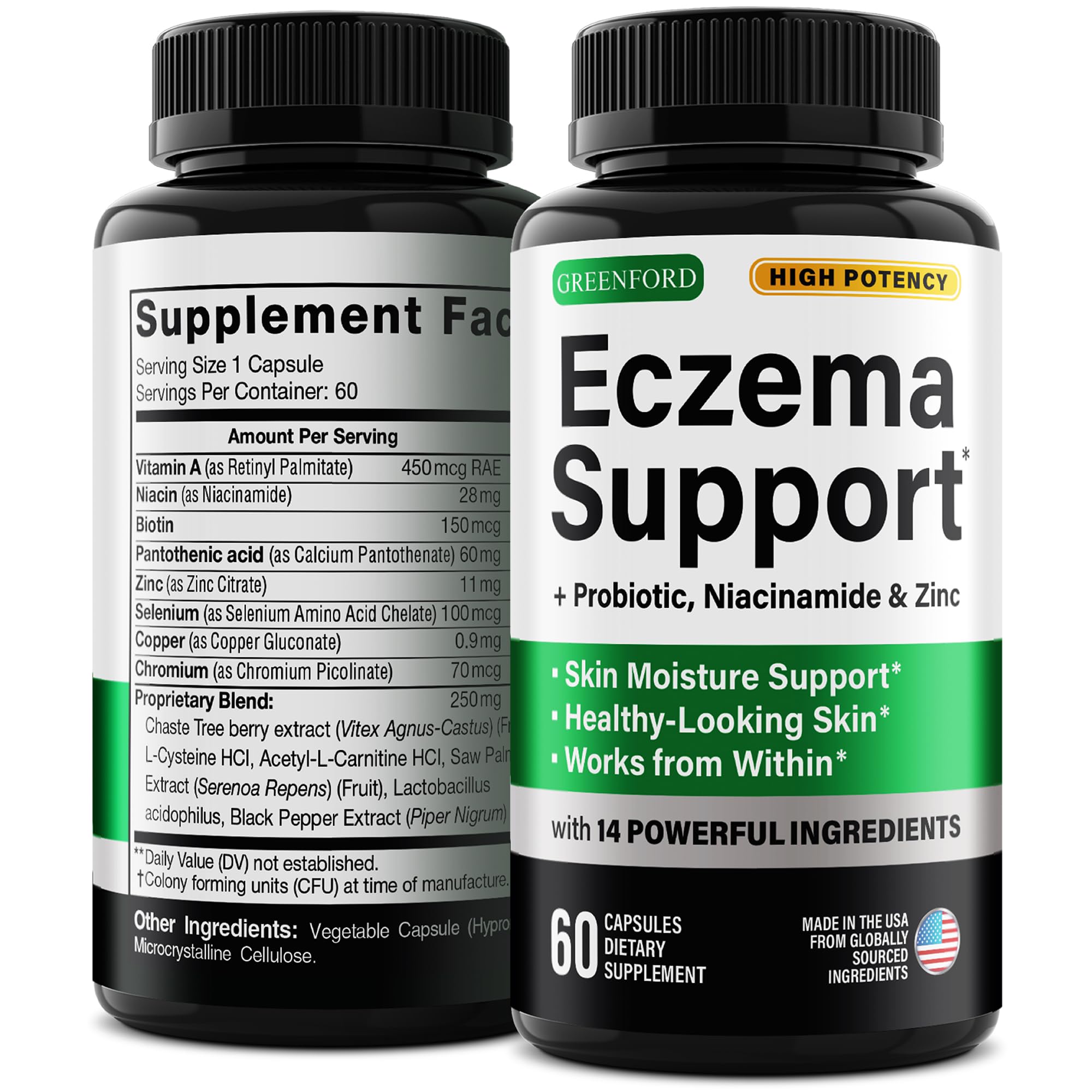 glutathione cure eczema Microneedling Combined With Promising in Treatment of Melasma Role of Oxidative Stress and