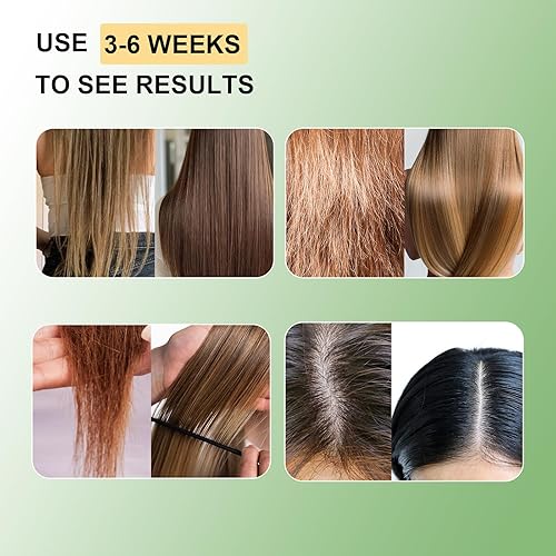 Miniatura 3 de Batana Oil Set para el cuidado del cabello, champú nutritivo y mezcla de crecimiento 4 en 1 con romero, aceite de batana para el crecimiento