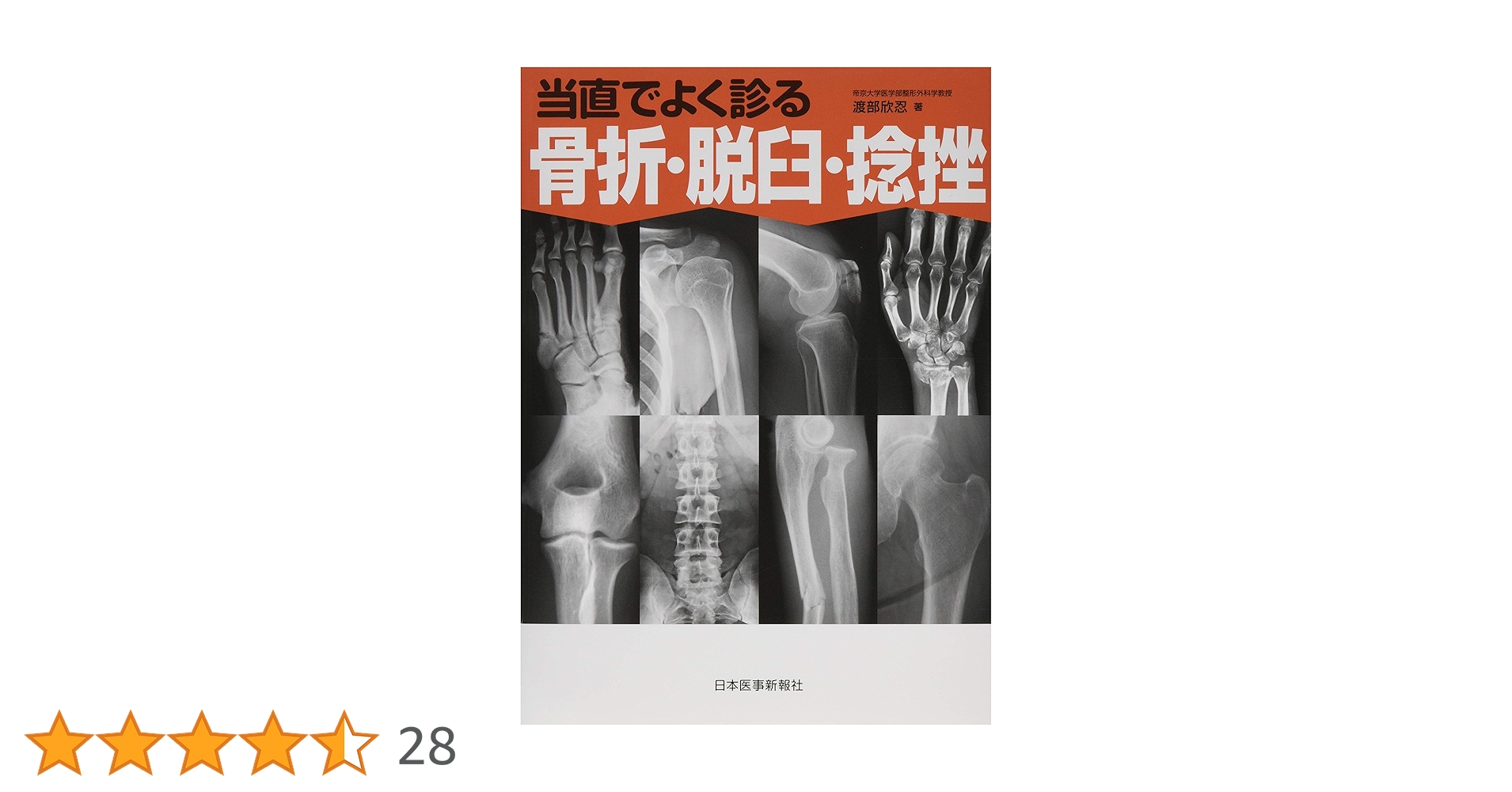 Amazon.co.jp: 当直でよく診る骨折・脱臼・捻挫《研修医☆万里小路尚子