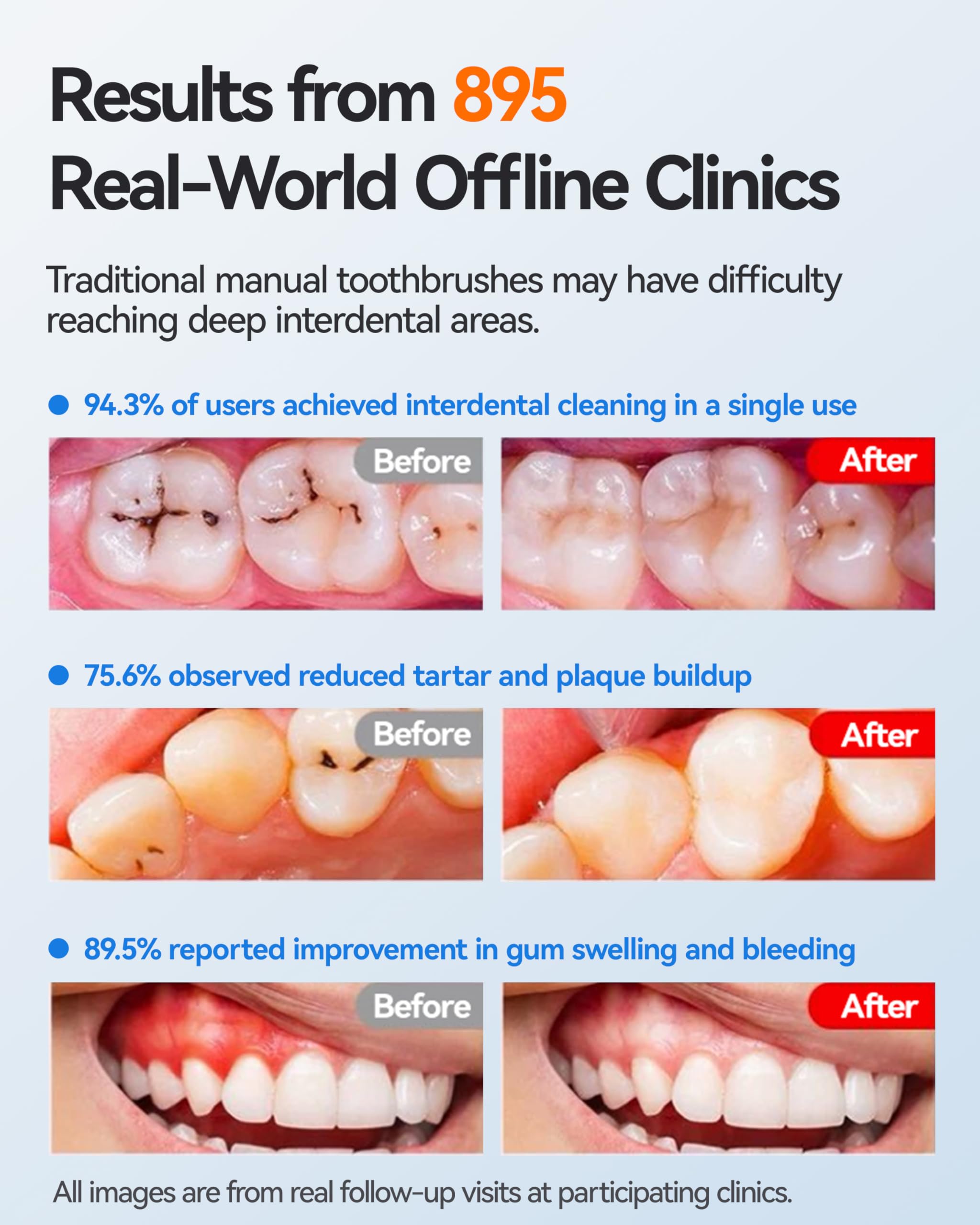 RANVOO Cepillo de dientes, temporizador de 3 modos, regalo para adultos, color blanco