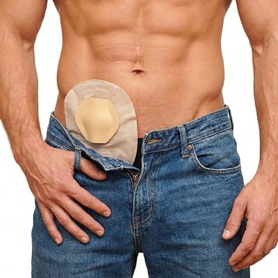 SIIL Stoma Protector | Stoma Guard Shield for Ostomy Bags & Ileostomy, Colostomy Bags | W/FREE supplies of VELCRO™ Stickers