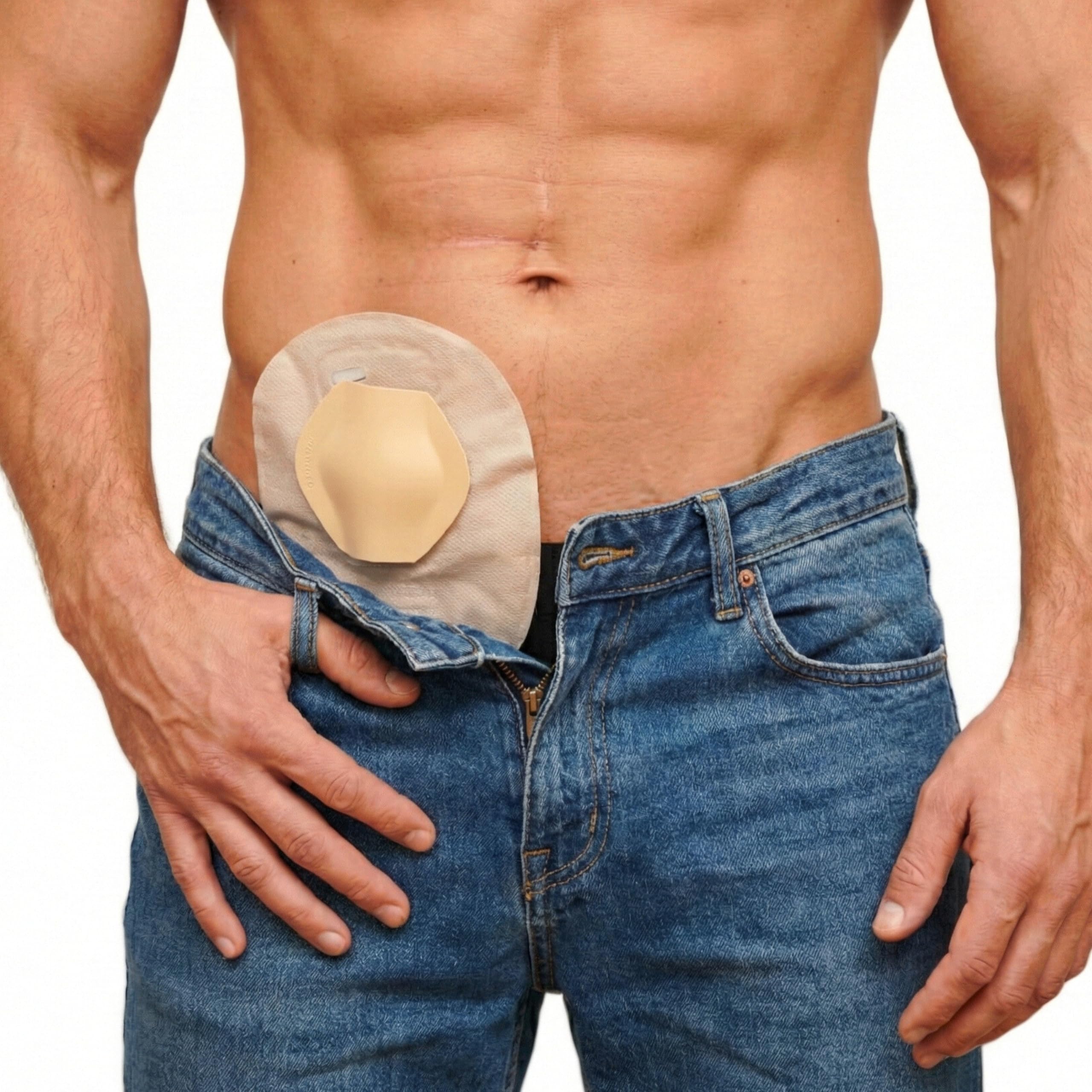 SIIL Stoma Guard Shield for Ostomy Bags - Protect Colostomy & Ileostomy Supplies with Stoma Protector - Compatible with All Ostomy Supplies