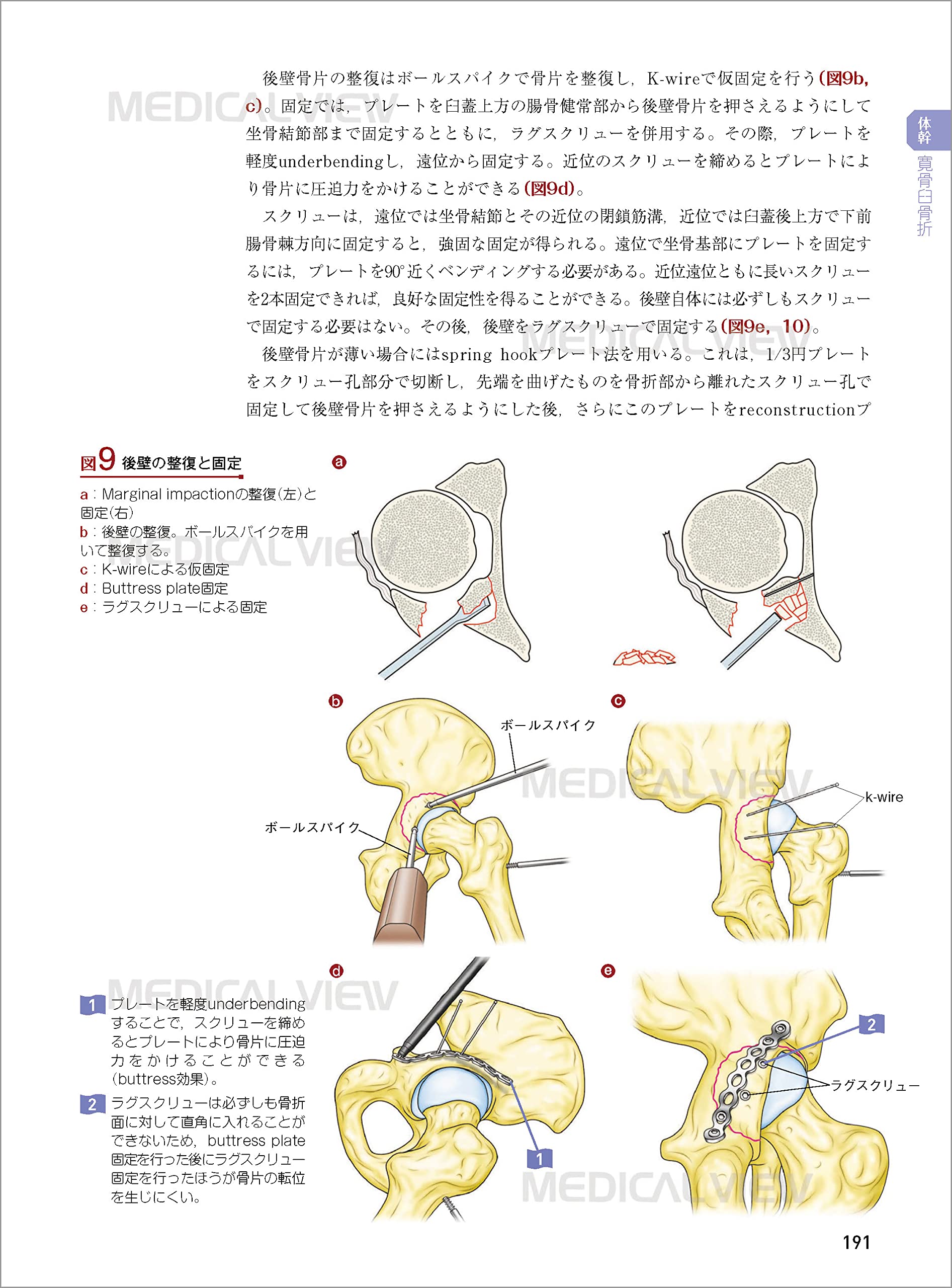 ギフ_包装】 骨折プレート治療マイスター hife.hr