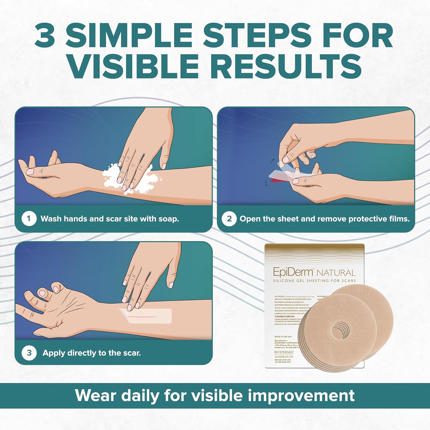 EpiDerm Areola Circles – Silicone Scar Sheets for Surgical Scars from Areola Reconstruction & Breast Augmentation - Washable & Reusable Silicone Sheets - Complements Mastopexy Forms - 5 Pairs, Natural