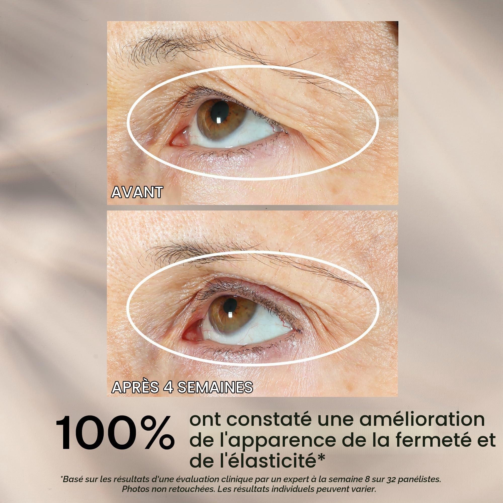 StriVectin Sérum Tenseur Liftant 360° pour Yeux 30ml 1 Unité