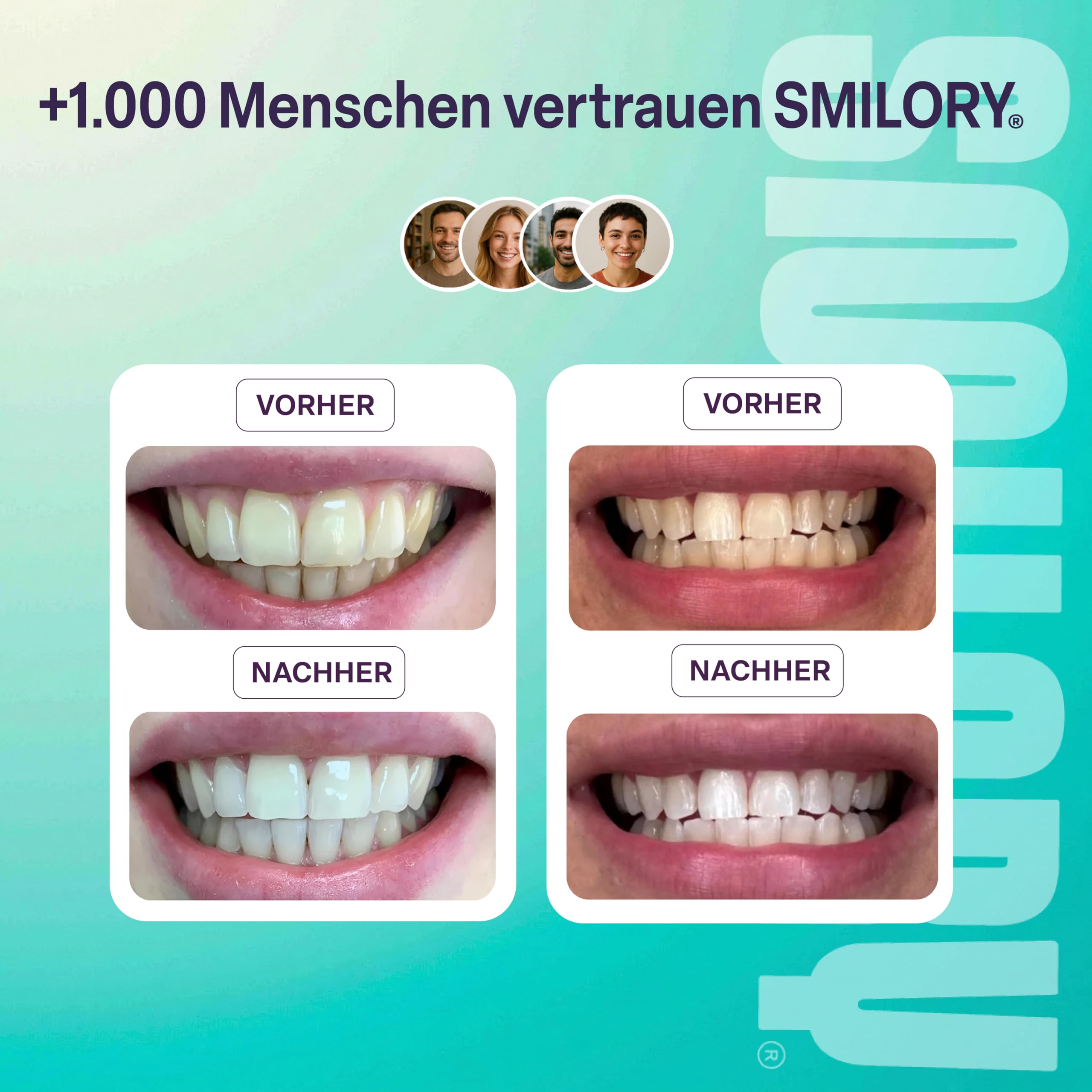 Smile Box - Kit professionale per sbiancamento dei denti bianchi - sbiancamento a lunga durata con aloe vera e olio di menta fresco