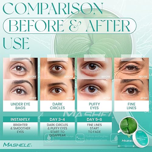 Miniatura 3 de 60 parches de gel coreano con colágeno y aloe vera para debajo de los ojos, tratamiento para ojos hinchados, ojeras, almohadillas antiarrugas