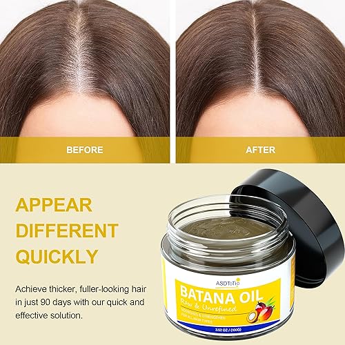 Miniatura 3 de Aceite de batana crudo para el crecimiento del cabello, 100% orgánico y natural, aceite de batana Dr. Sebi, evita la pérdida de cabello, hidrata el