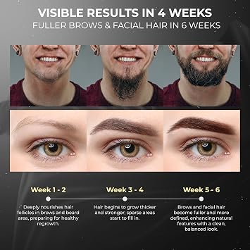 ABERA Ginb Eyebrow Growth Serum for Women & Men, Growth Beard serum For Men Natural Brow Enhancing Serum to Grow Thicker, Acetyl Tetrapeptide-3 Biotin & Castor Oil for Stronger, Thicker Beard