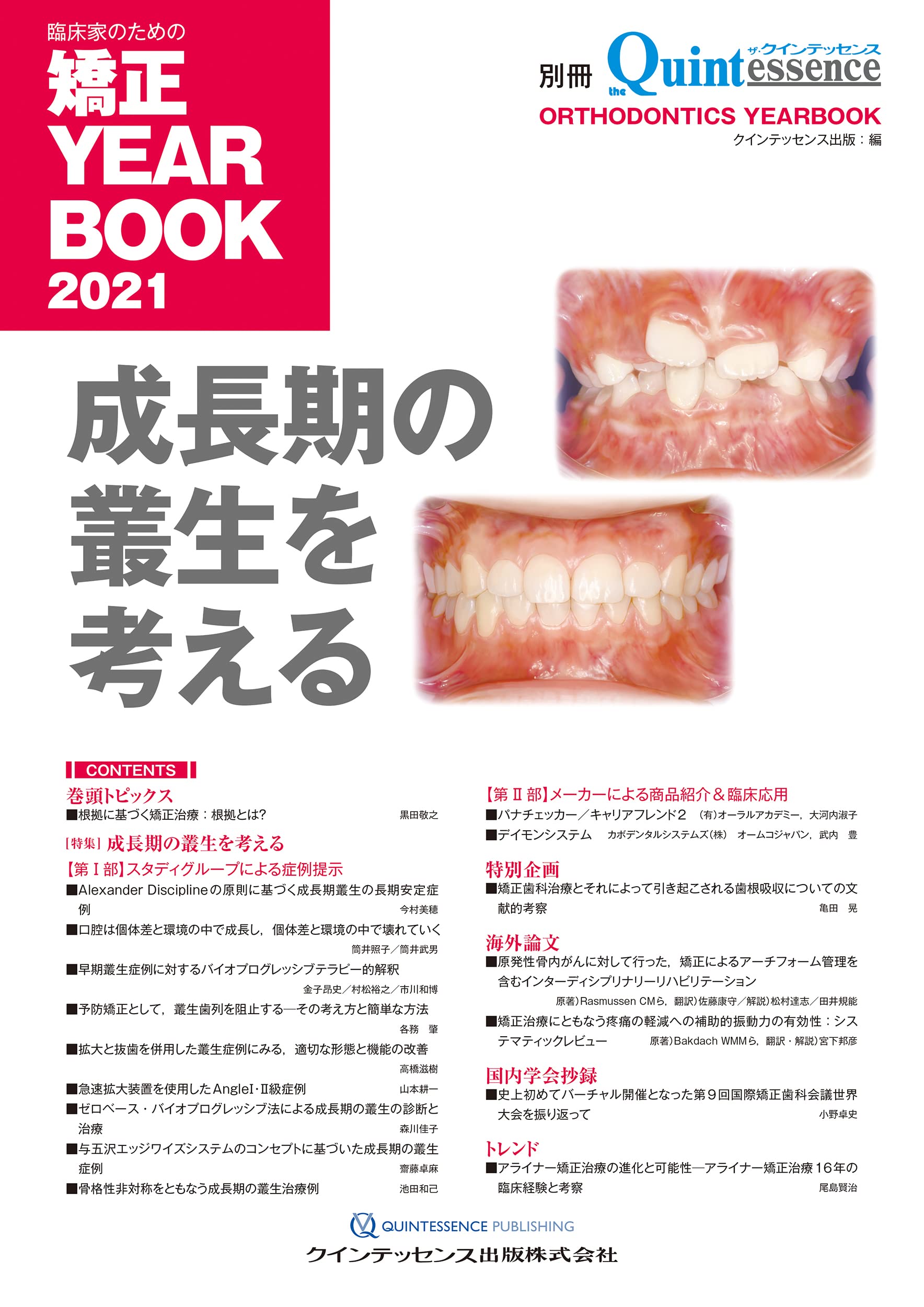 臨床家のための矯正ＹＥＡＲ　ＢＯＯＫ ２０１３/クインテッセンス出版（単行本（ソフトカバー）） 臨床家のための矯正 YEAR BOOK 2013 - クインテッセンス出版