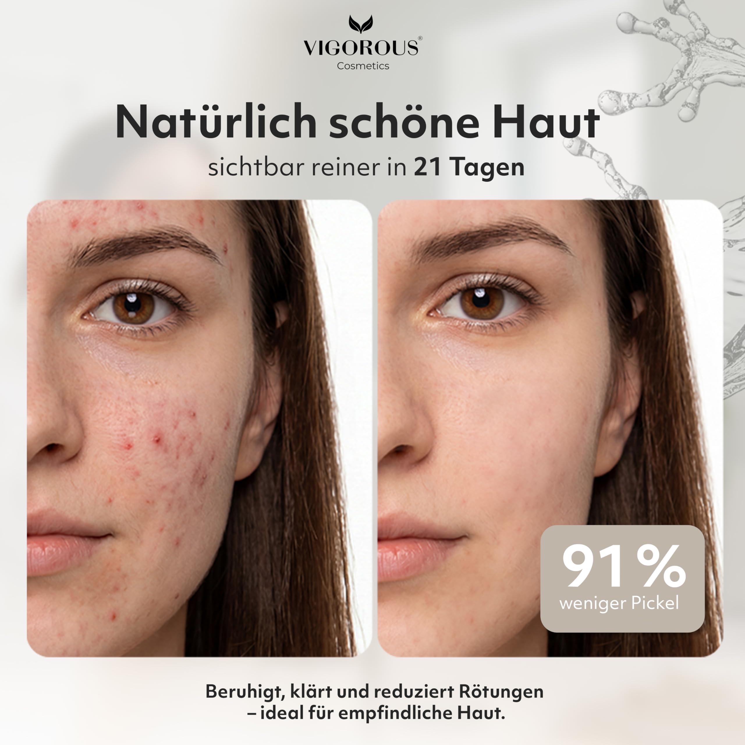 VIGOROUS® Zink Gesichtswasser 120ml anti Pickel Gesichtsreinigung Männer & Frauen- Salicylsäure & Niacinamide face cleanser gegen unreine Haut Gesicht - Vegan gegen Pickel im Gesicht & hormonelle Akne