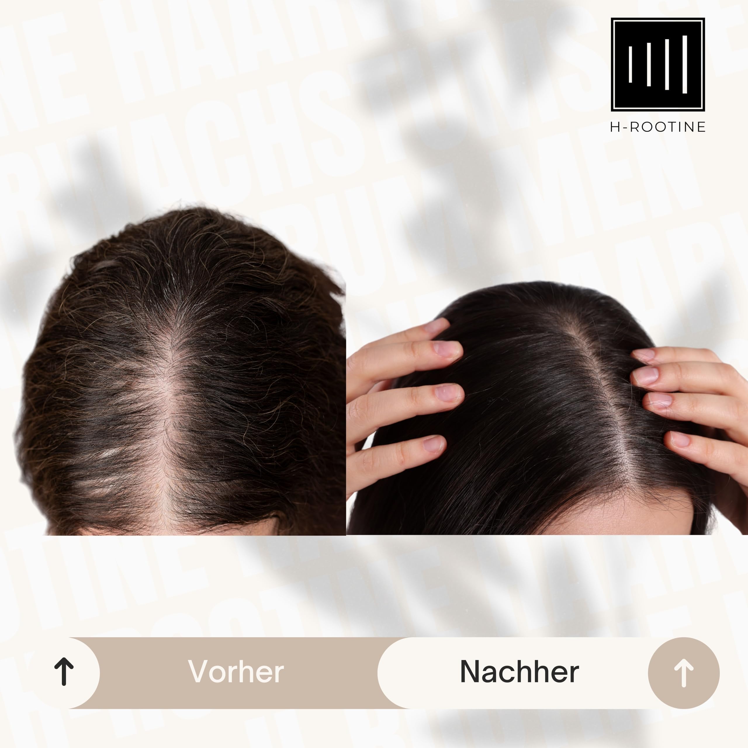 Haarwachstum Serum Frauen (75ml) - Anti Hair Loss & Haarwuchsmittel für Damen - Haarserum für Wachstum & Haarwachstum beschleunigen - Veganes Hair Growth Serum
