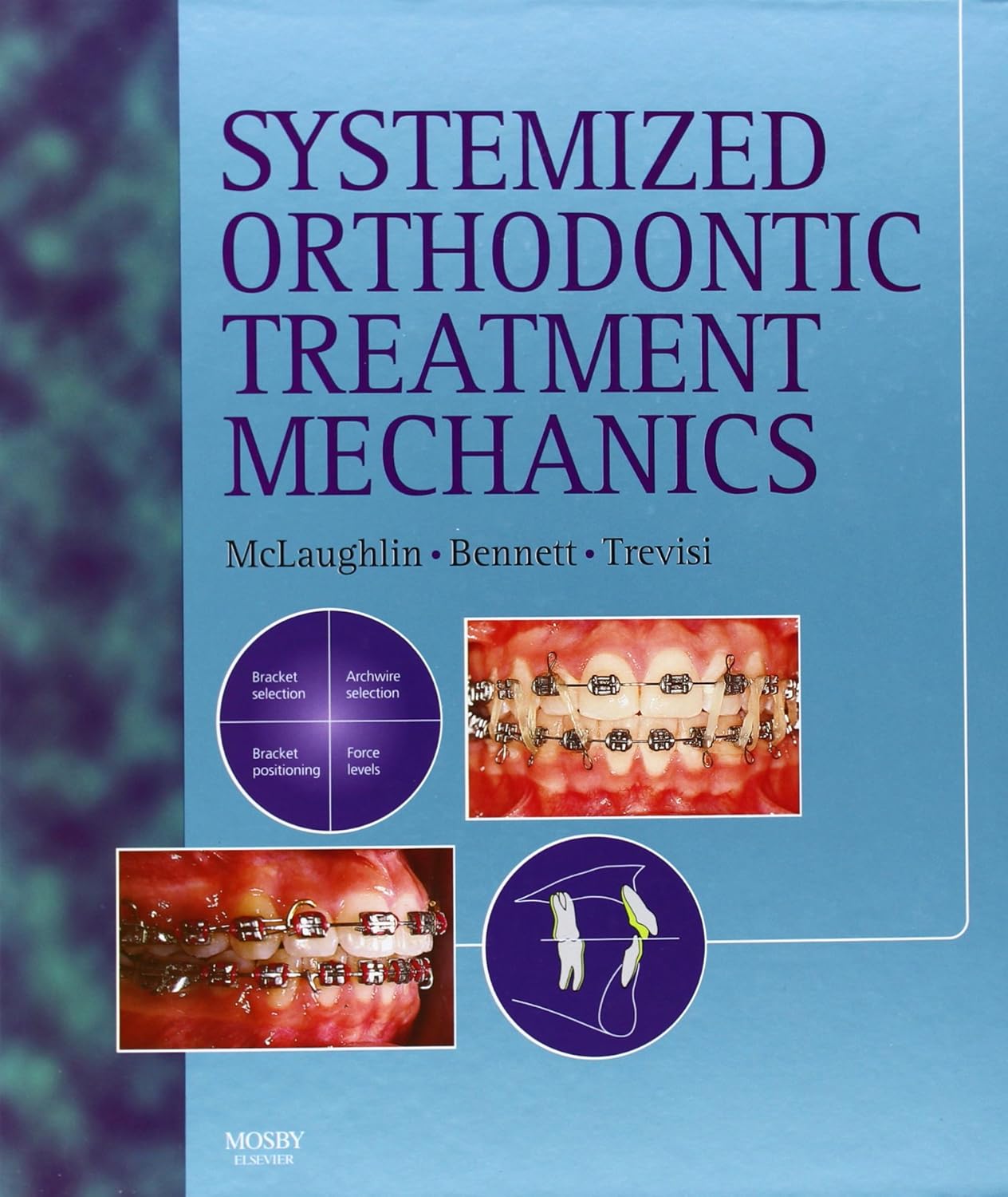 Systemized Orthodontic Treatment Mechanics 9780723431718 Medicine