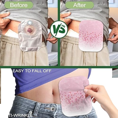 Miniatura 5 de Rnyleeg Bolsas de colostomía rosa para mujer, paquete de 4 fundas para ostomía de flor de cerezo con cierre, suministros reutilizables de ostomía