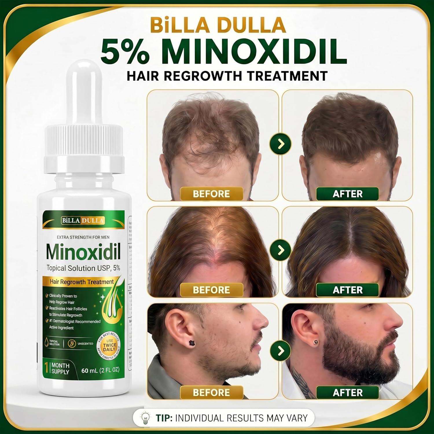 Minoxidil for Men,Minoxidil 5% hair Regrowth Treatment for Men,Extra Strength,Topical Hair loss Treatment for men Thinning Hair and Receding Hairline,Topical Solution USP Unscented. (6 pack)