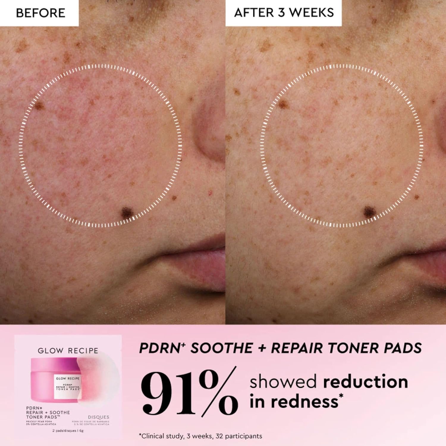 Glow Recipe Toner Pads Kit Trial Set, 12-Piece Korean Toner Pad Kit with Exfoliating, Soothing & Brightening Pads, Fragrance-Free 5-Minute Facial Treatment for Sensitive Skin