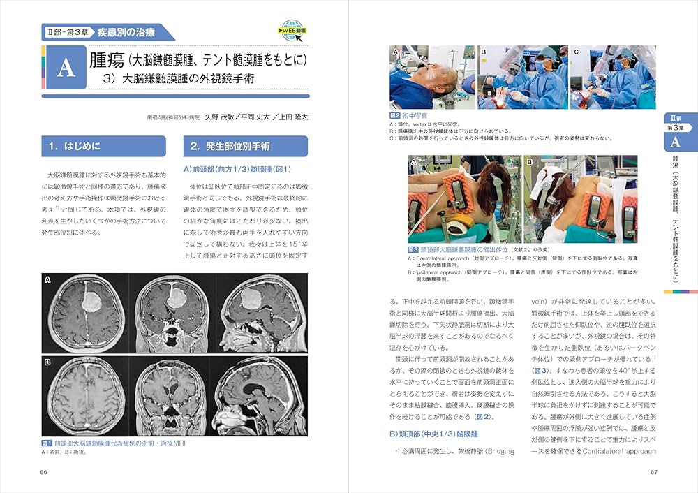 脳神経外科 外視鏡手術 Professional：顕微鏡・神経内視鏡の理解を