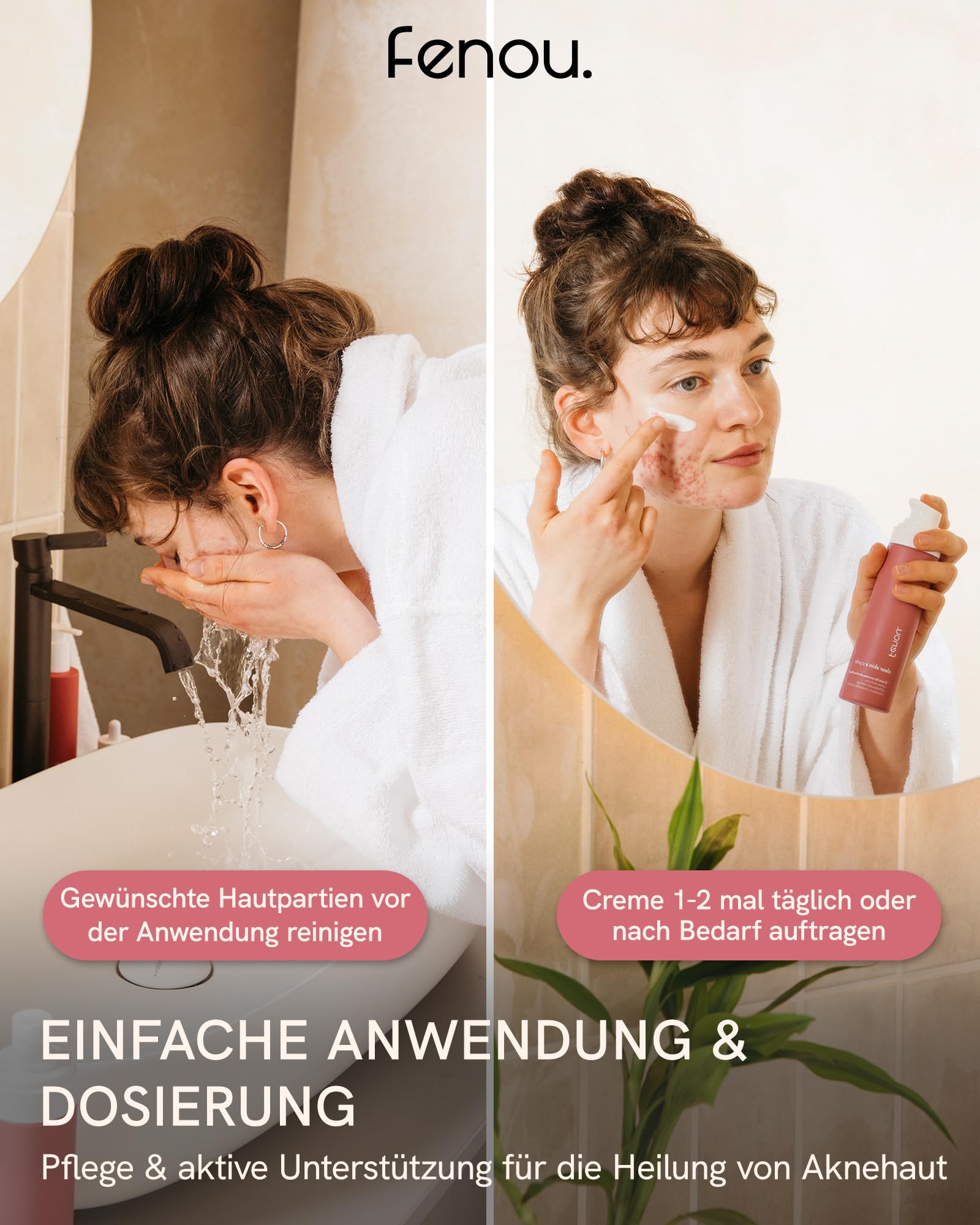 Fenou Akne-Creme für unreine Haut | Hautbarriere-Stärkung mit OLT®-Technologie | Ohne schädliche Inhaltsstoffe | Clear Skin Pflege für Frauen ab 20