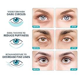 Stylia Under Eye Patches for Puffy Eyes and Dark Circles (12 Pairs) - Marine Collagen Under Eye Mask with Vitamin C, Hyaluronic Acid, Pearl Extract - Eye Masks for Dark Circles and Puffiness