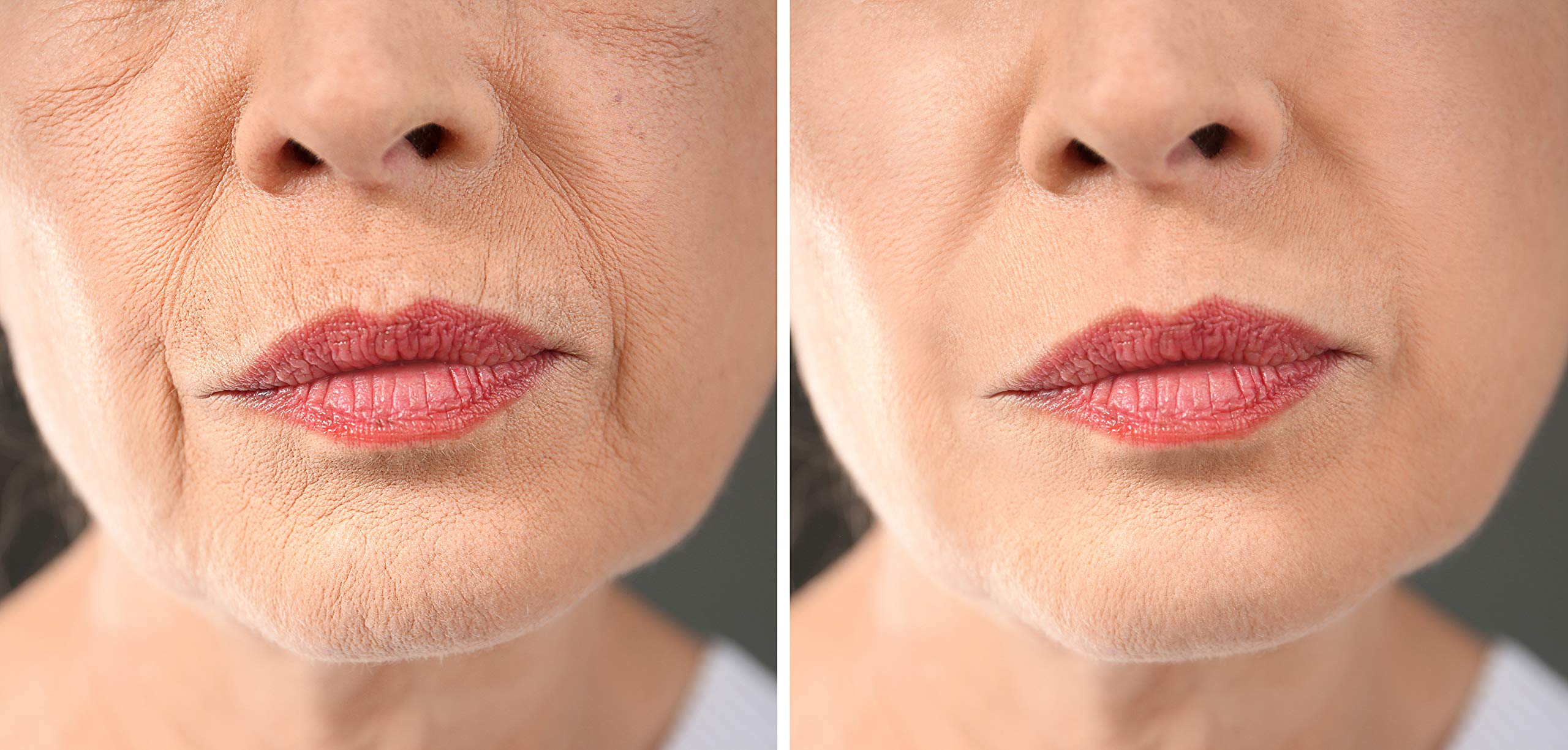 RADICAL CHANGE - Corrector ojeras – Alisador plus, líneas de expresión, elimina las bolsas de los ojos de forma rápida - efectividad comprobada