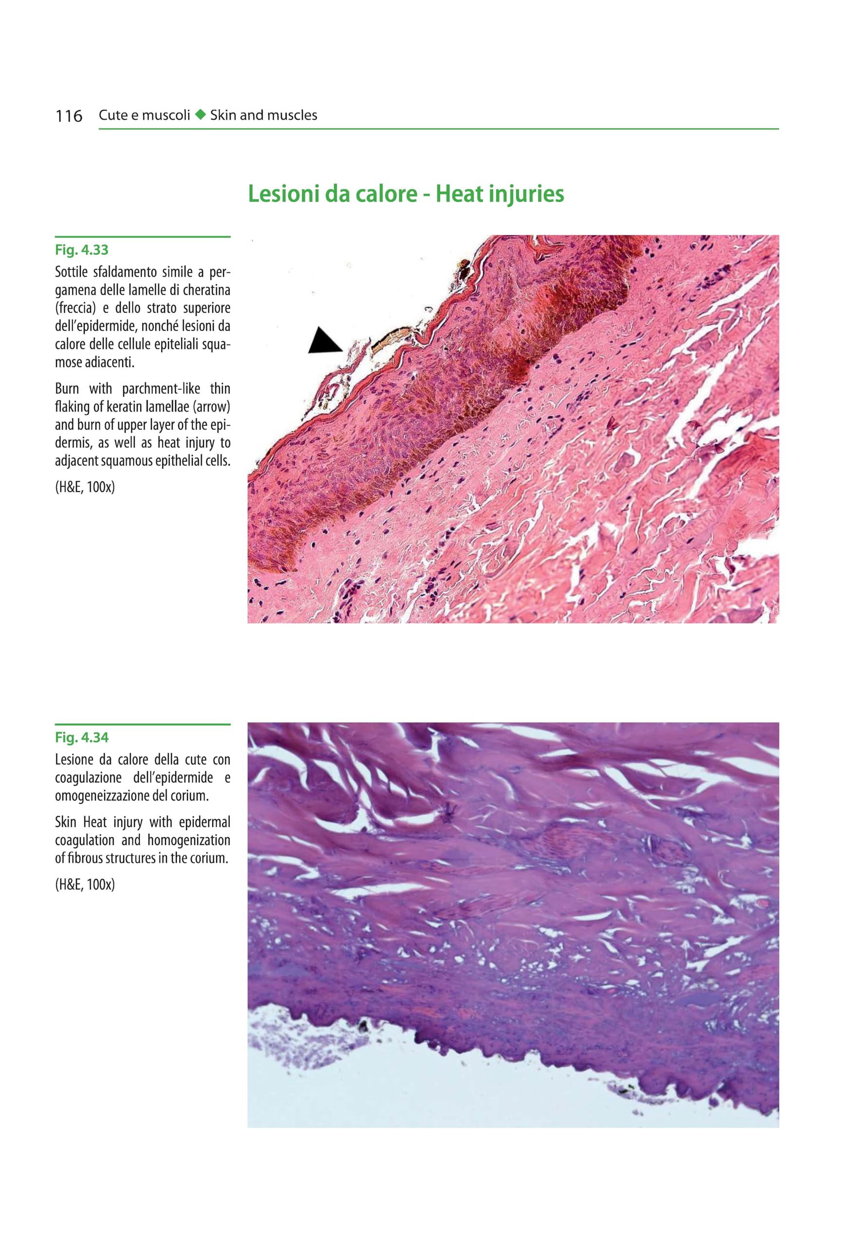 Atlante di istopatologia forense-Atlas of forensic histopathology. Ediz. bilingue
