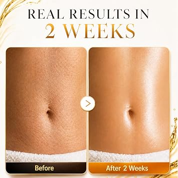 Body Firming Oil, Remedy Body Oil for Women After Shower, Toning & Tightening Treatment for Crepey Skin, Natural Firming Oil for Dry Skin, Non-Greasy Body Serum 3.38 Fl Oz