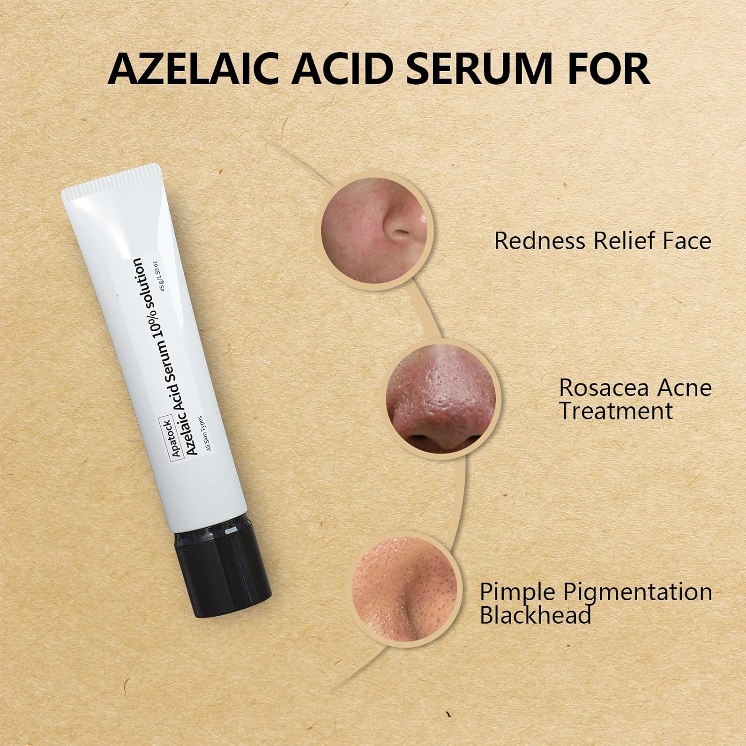 10% Azelaic Acid Serum Solution Apatock,Rosacea Treatment for Face,Dark Spot Remover,Redness Relief for Face，Natural Extracts Gently Acne Treating (1.4 oz（Pack of 1）)