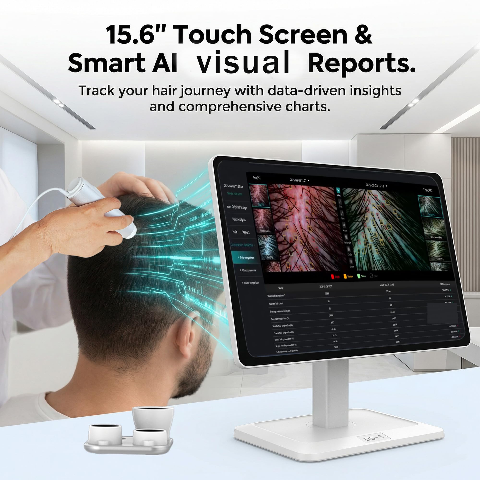 DS3-AI Kopfhautanalysegerät – mit 39,6 cm (15,6 Zoll) Touchscreen, 16 MP HD-Kamera und 4 Objektive (10 x 200 x), dreispektraler Haarfollikel-Scanner für Kopfhaut-Wellness und Salonpflege, mit