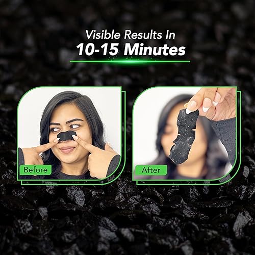 Miniatura 5 de DR.RASHEL Tiras de poros de nariz de carbón para limpieza de poros, eliminación instantánea e indolora de puntos negros | Tiras eliminadoras de