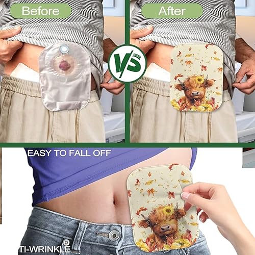 Miniatura 5 de Fundas para bolsas de ostomía para mujeres y hombres, bolsas de colostomía, fundas para bolsas de ileostomía, control de olores, protector