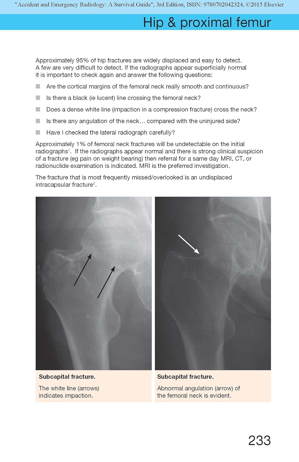 Accident and Emergency Radiology: A Survival Guide