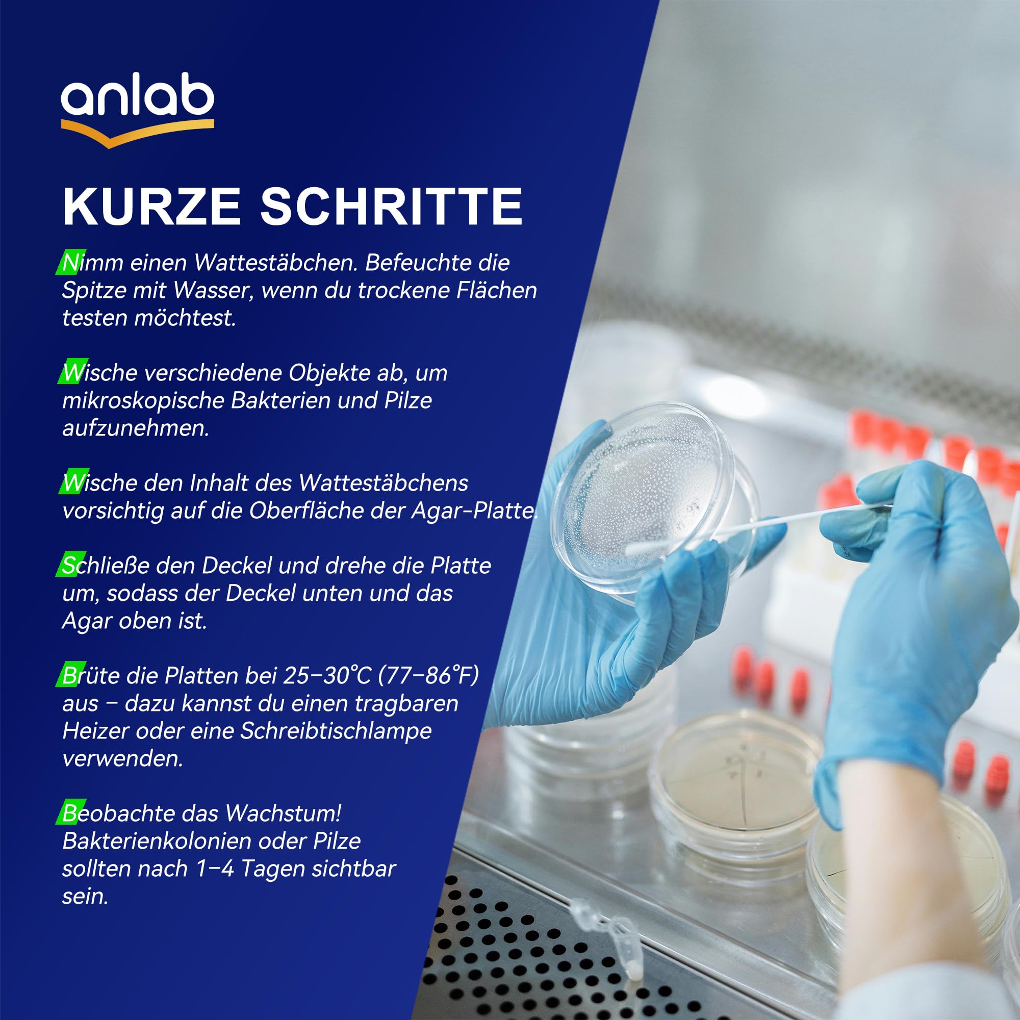 Nutrient Agar Petri Dishes Science Project Kit | Wstępnie nalane talerze agarowe i waciki bawełniane do eksperymentów naukowych, zestaw do nauki o bakteriach, szczelny oddzielnie (30)