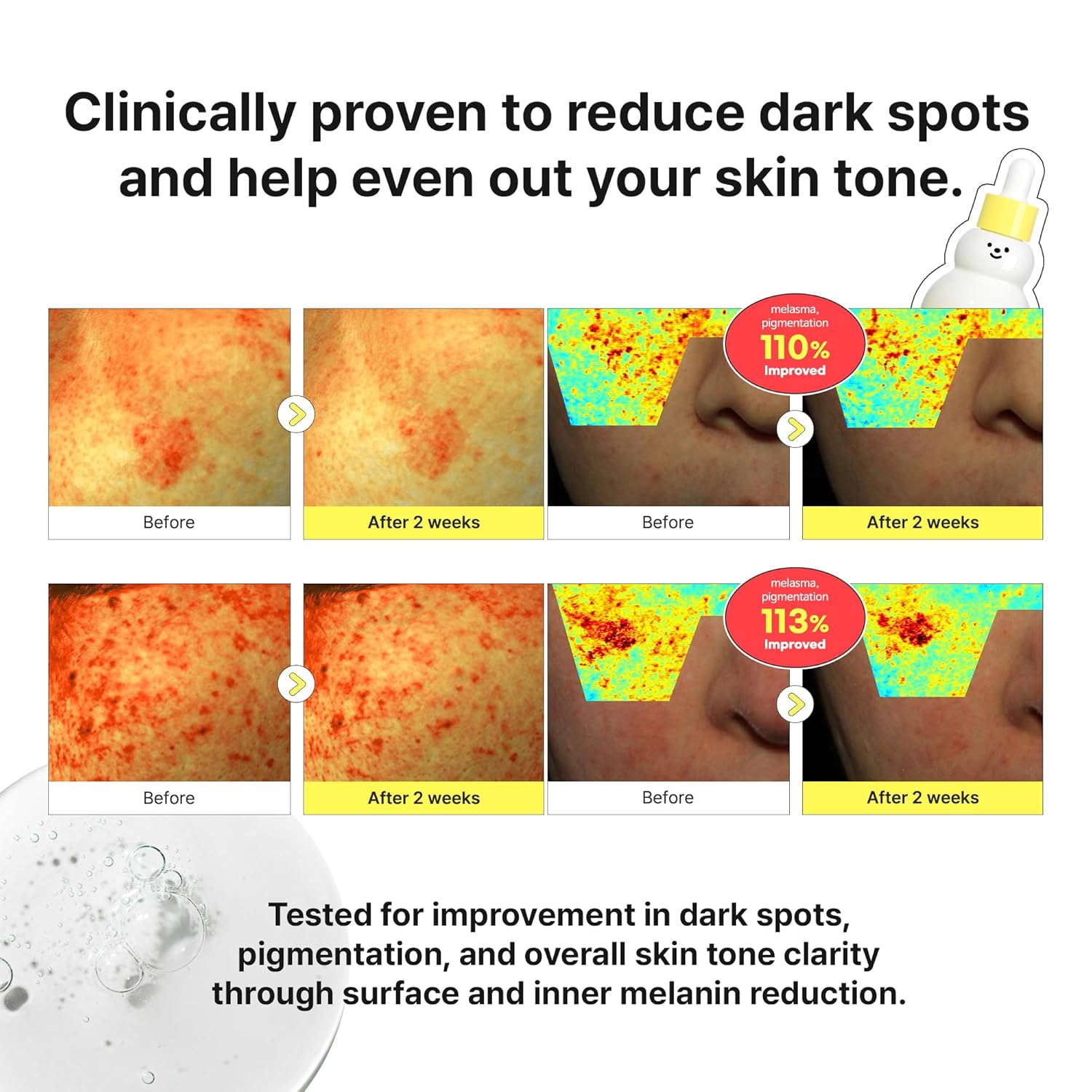 TIAM Vita B3 Source Serum Snowman, 10% Niacinamide Glow Serum with 2% Arbutin for Dark Spots, Uneven Skin Tone, Fast-Absorbing, Vegan Korean Skincare -1.35 fl oz (40ml)