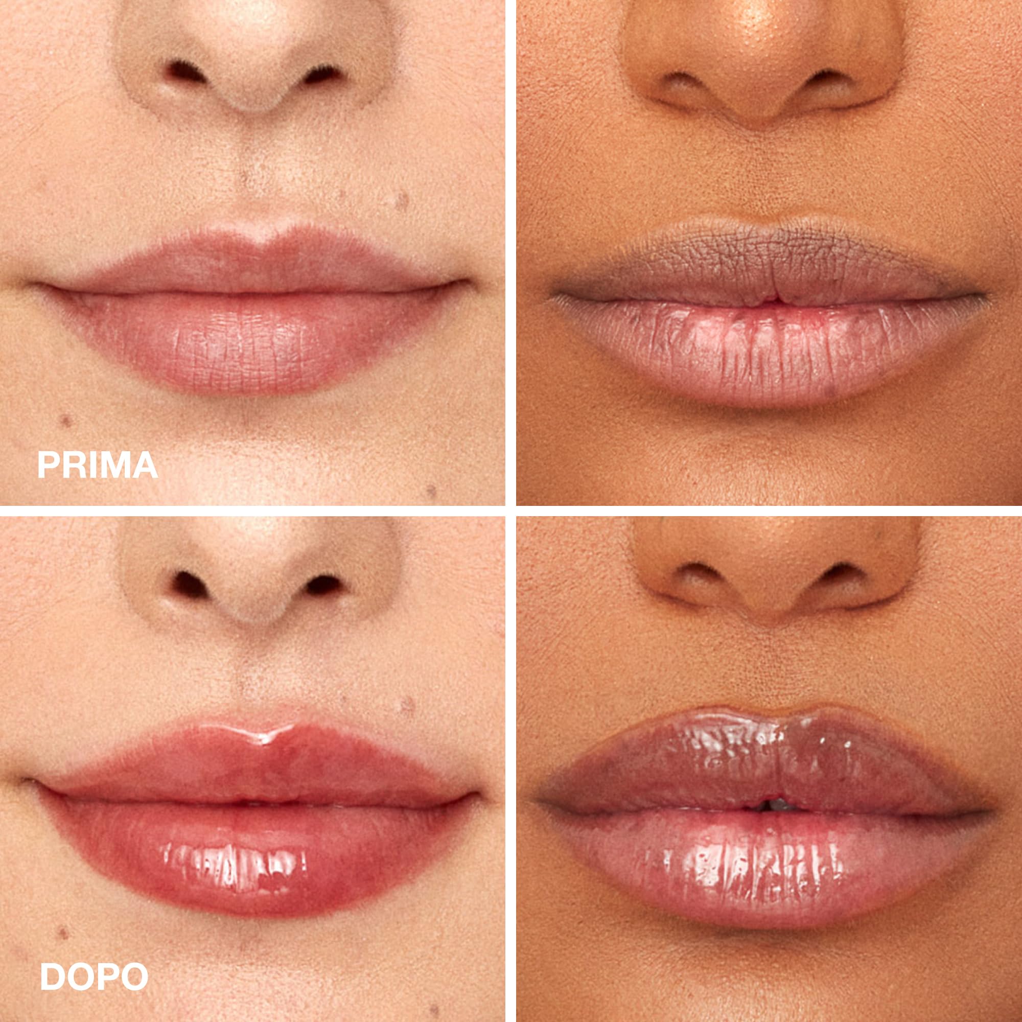 NABLA Viper Lip Plumper | Balsamo labbra volumizzante trasparente con effetto rimpolpante, nutriente e antiossidante. Clinicamente testato per un effetto volume immediato di almeno 2 ore.