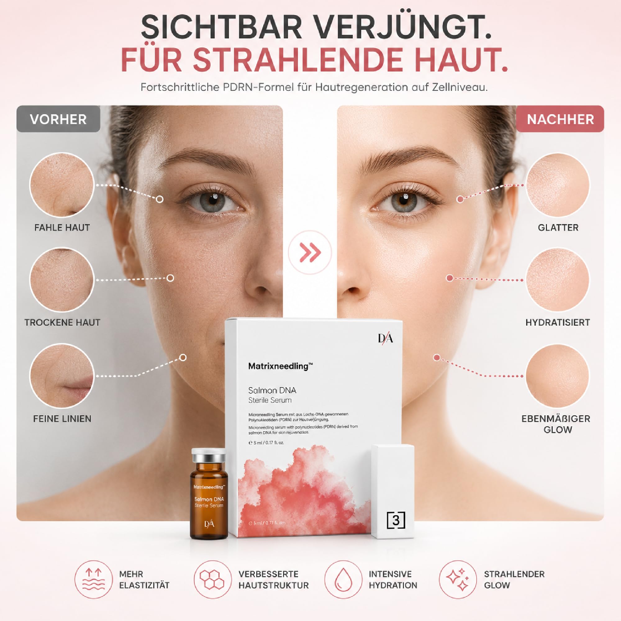 Matrixneedling™ Salmon DNA PDRN Serum – Steriles Microneedling Serum mit Polynukleotiden aus Lachs DNA, Niacinamide & Kollagen Booster – Anti Aging Collagen Peptide Serum