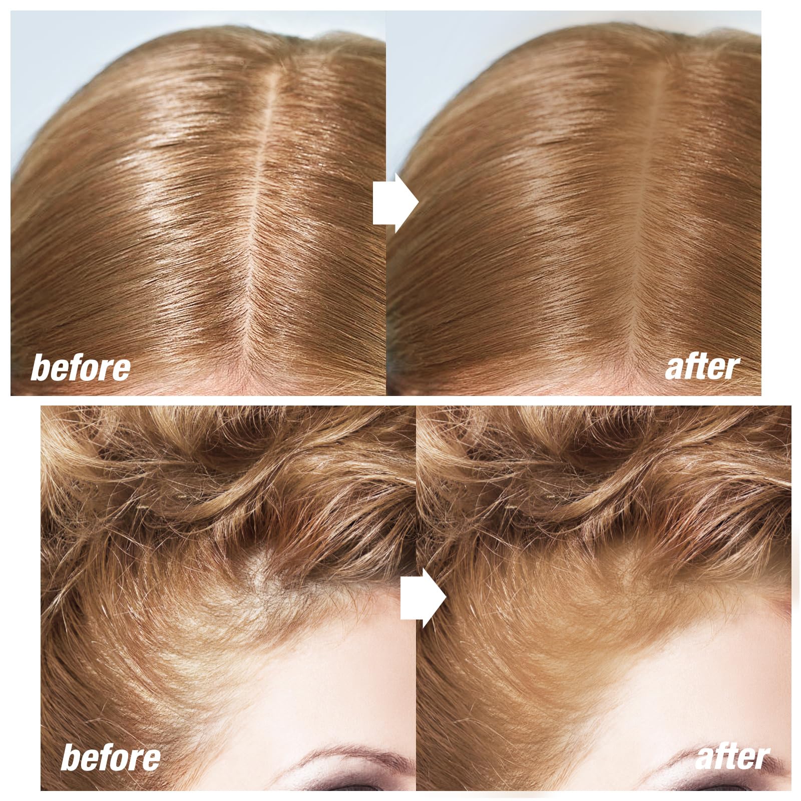 Boobeen Hairline Shadow Stick, Hair Root Concealer & Touch Up Powder With Sponge, Instant Cover Up For Thinning Grey Hair - Image 2