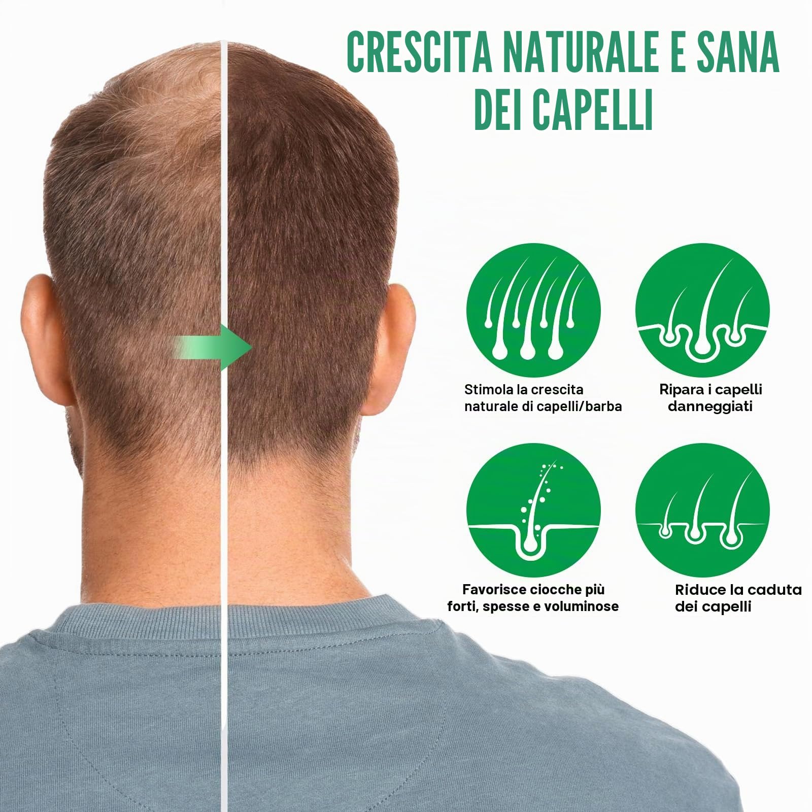 Spray di siero per la crescita dei capelli, olio naturale per la crescita dei capelli con olio biologico di rosmarino, olio di ricino, olio Batana e biotina, crescita dei capelli più sottili