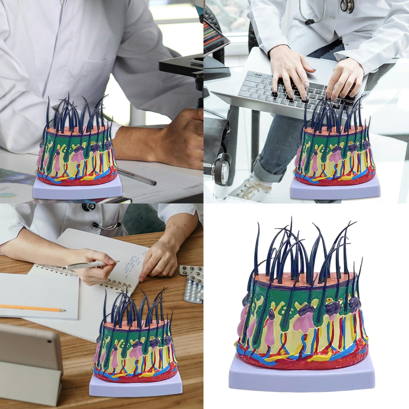 Human Scalp Model 50X Enlarged Scalp Structure Anatomical Model Teaching Medicals Model for Classroom Science Study