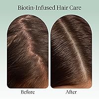 Vista 4 de Kitsch Aceite de romero para el crecimiento del cabello – Aceite para el cabello con biotina, ricino y jojoba – Aceite de cuero cabelludo prelavado