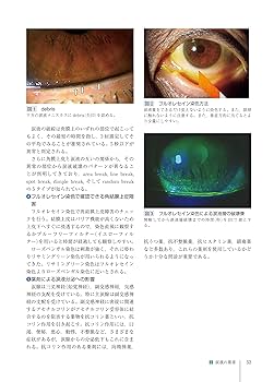 角膜クリニック 第3版 Amazon.co.jp: 角膜クリニック 第3版 : 眞鍋 禮三, 木下 茂