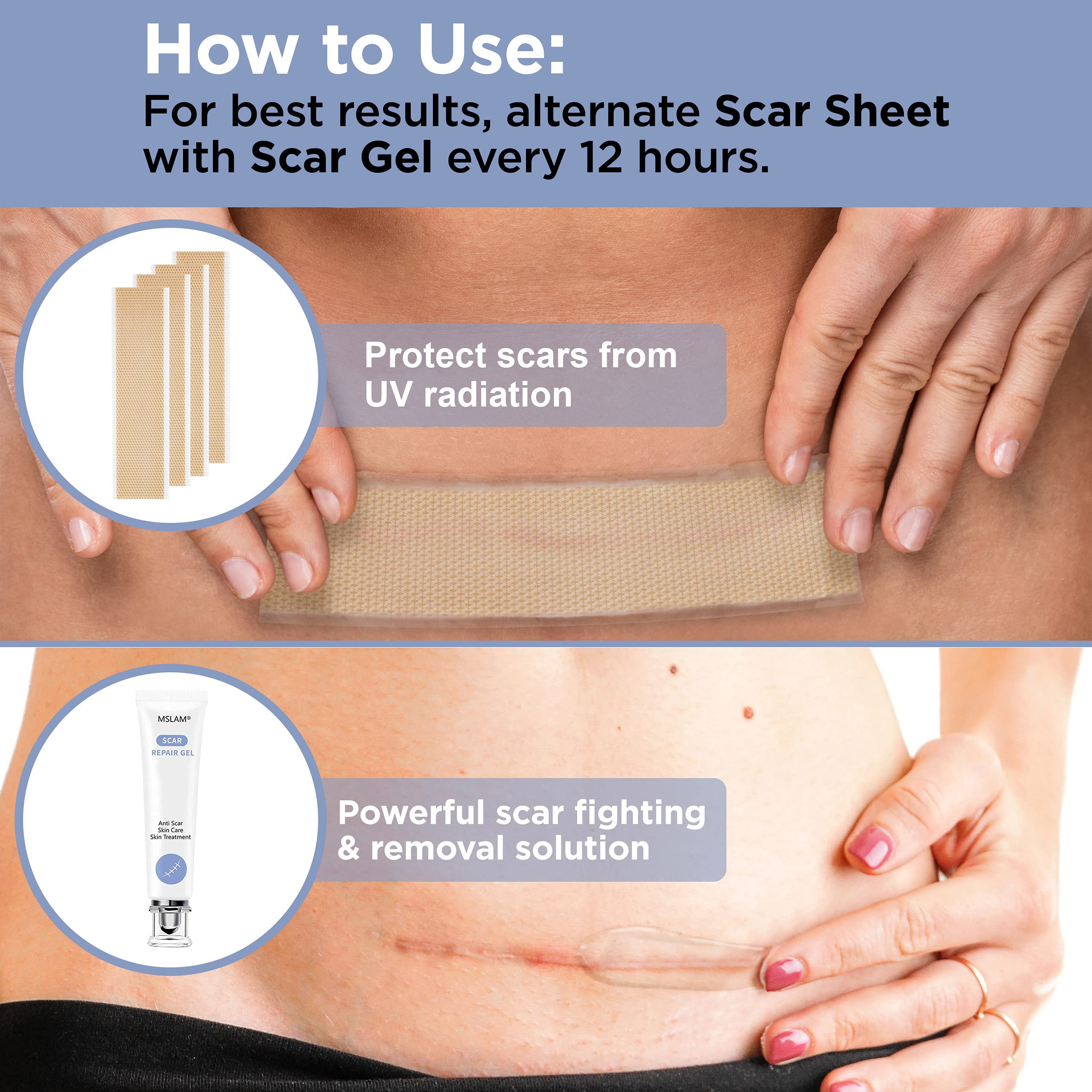 Silicone Scar Sheets Scar Treatment Gel 5 Pack Keloid Scar Removal