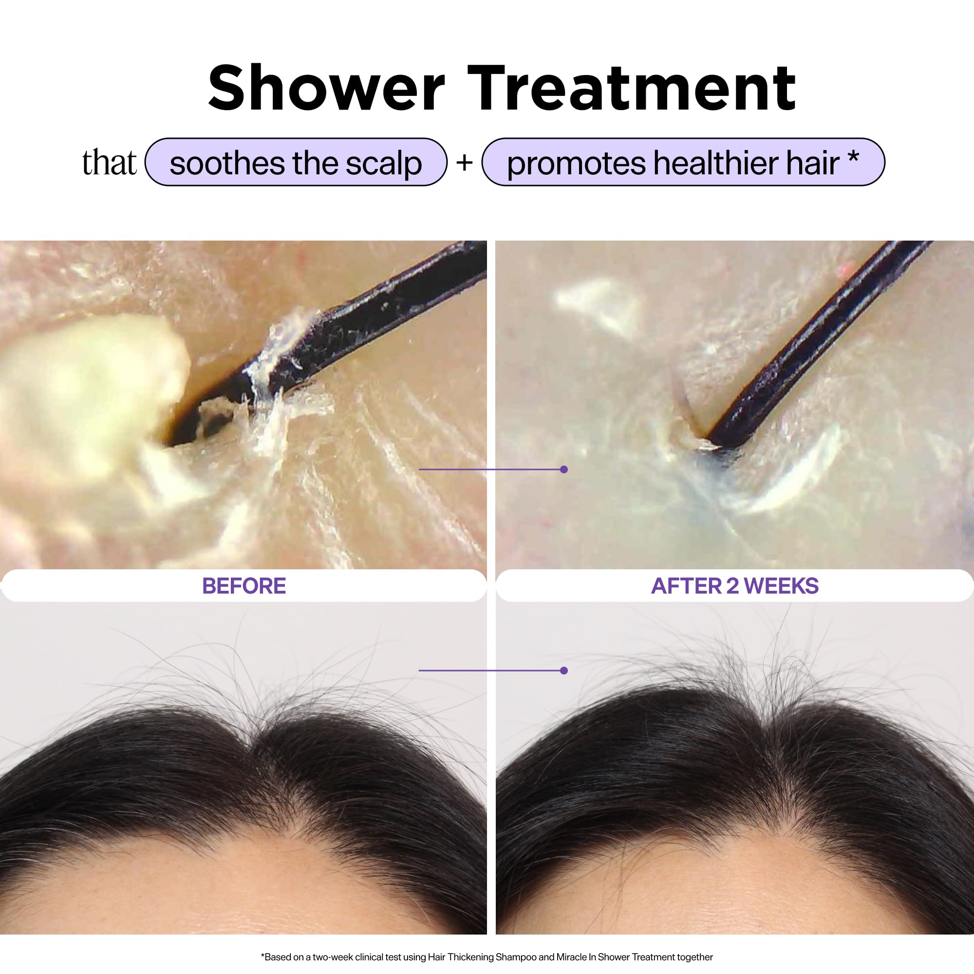 Dr. Groot SRS Miracle In Shower Treatment 250ml