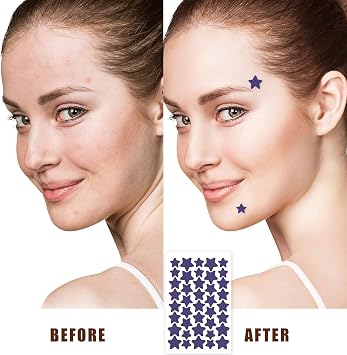 Star Face Pimple Patches, 1120PCS/28Sheets, Size 10/12/14mm, 7 Colors