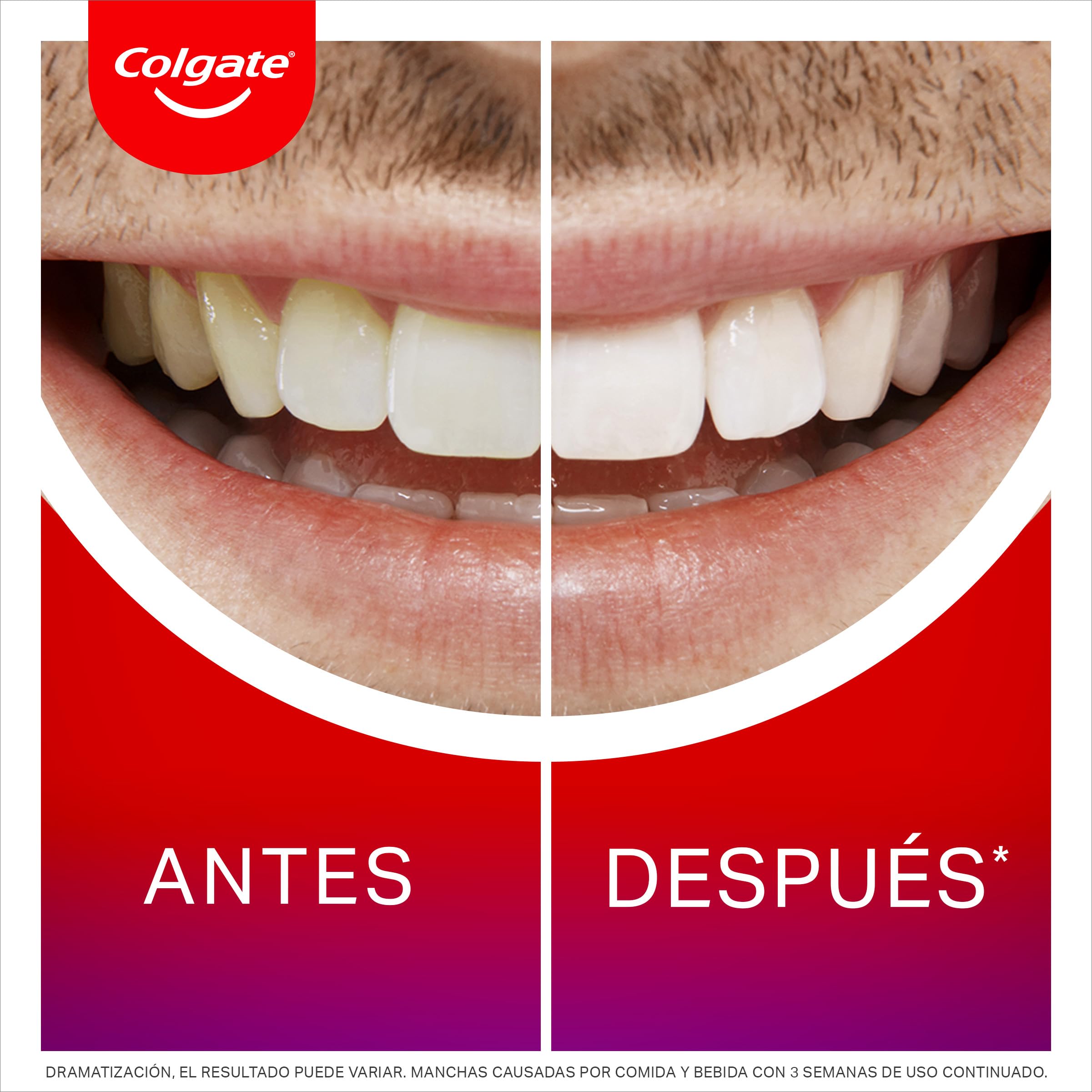 Colgate Max White Sérum Blanqueador Nocturno (2,5ml) | Blanqueador de Dientes en Casa | Revela 3 Tonos de Blanco* mientras Duermes | Aplicador Nuevo y Mejorado | Seguro para el Esmalte
