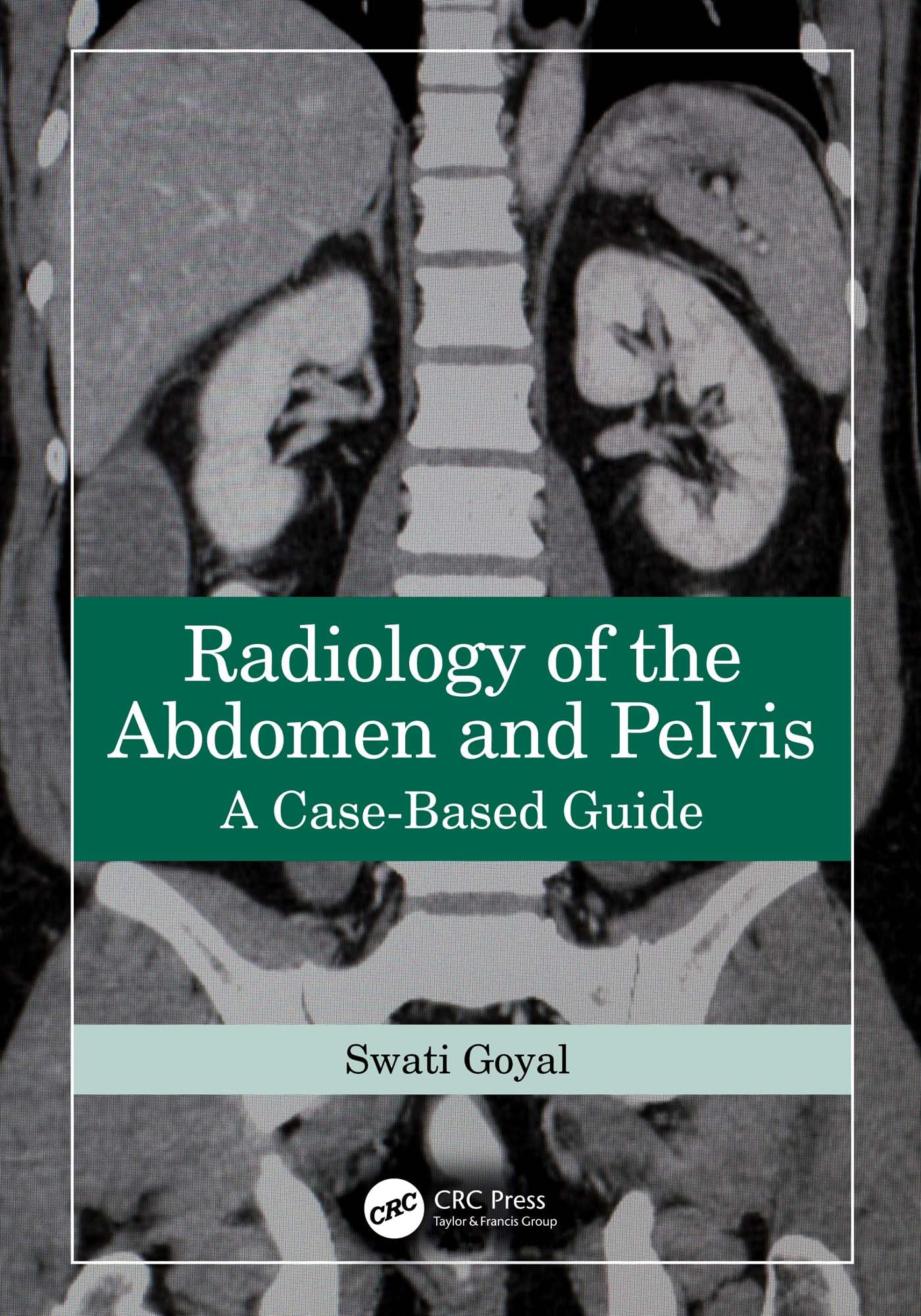 Radiology of the Abdomen and Pelvis: A Case-Based Guide (English Edition)