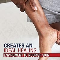 Vista 11 de Aquaphor Ungüento curativo, protector de la piel de terapia avanzada, ungüento curativo multiusos e hidratante corporal, regalos navideños