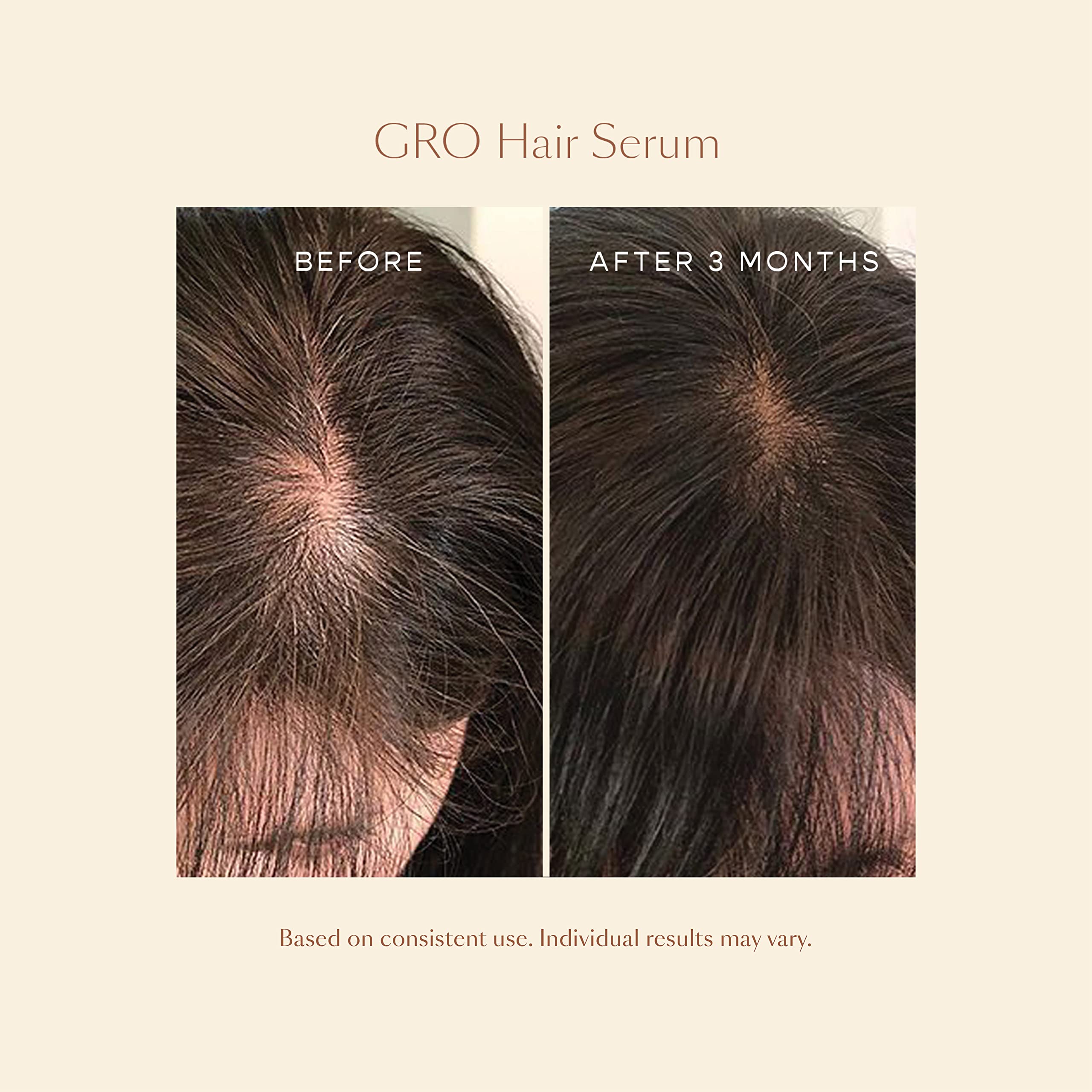 VEGAMOUR GRO Hair Serum for Thicker, Visibly Longer Hair Vegan Hair